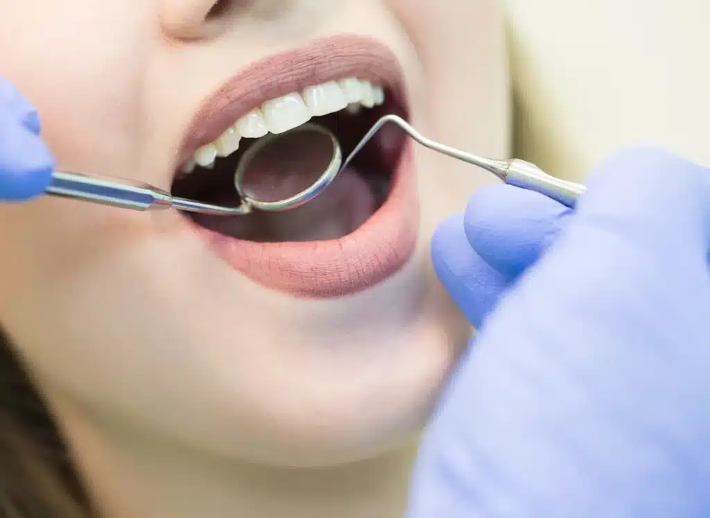 How to Improve Oral Health