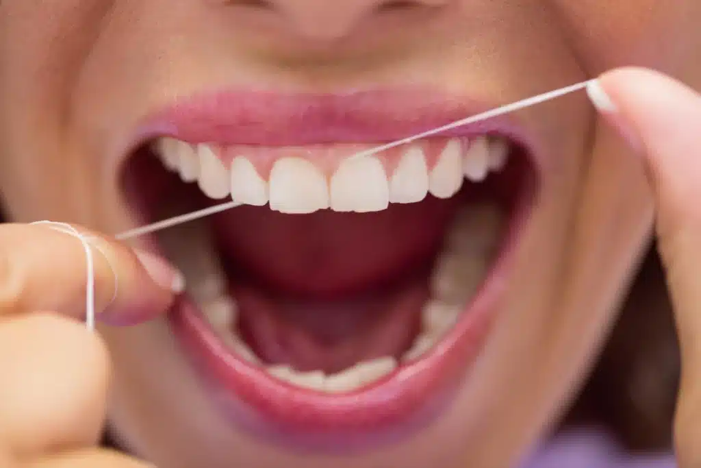Interdental Brushes vs Dental Floss