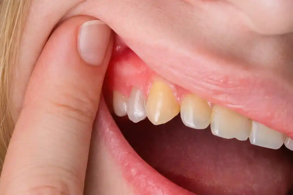 common dental problems