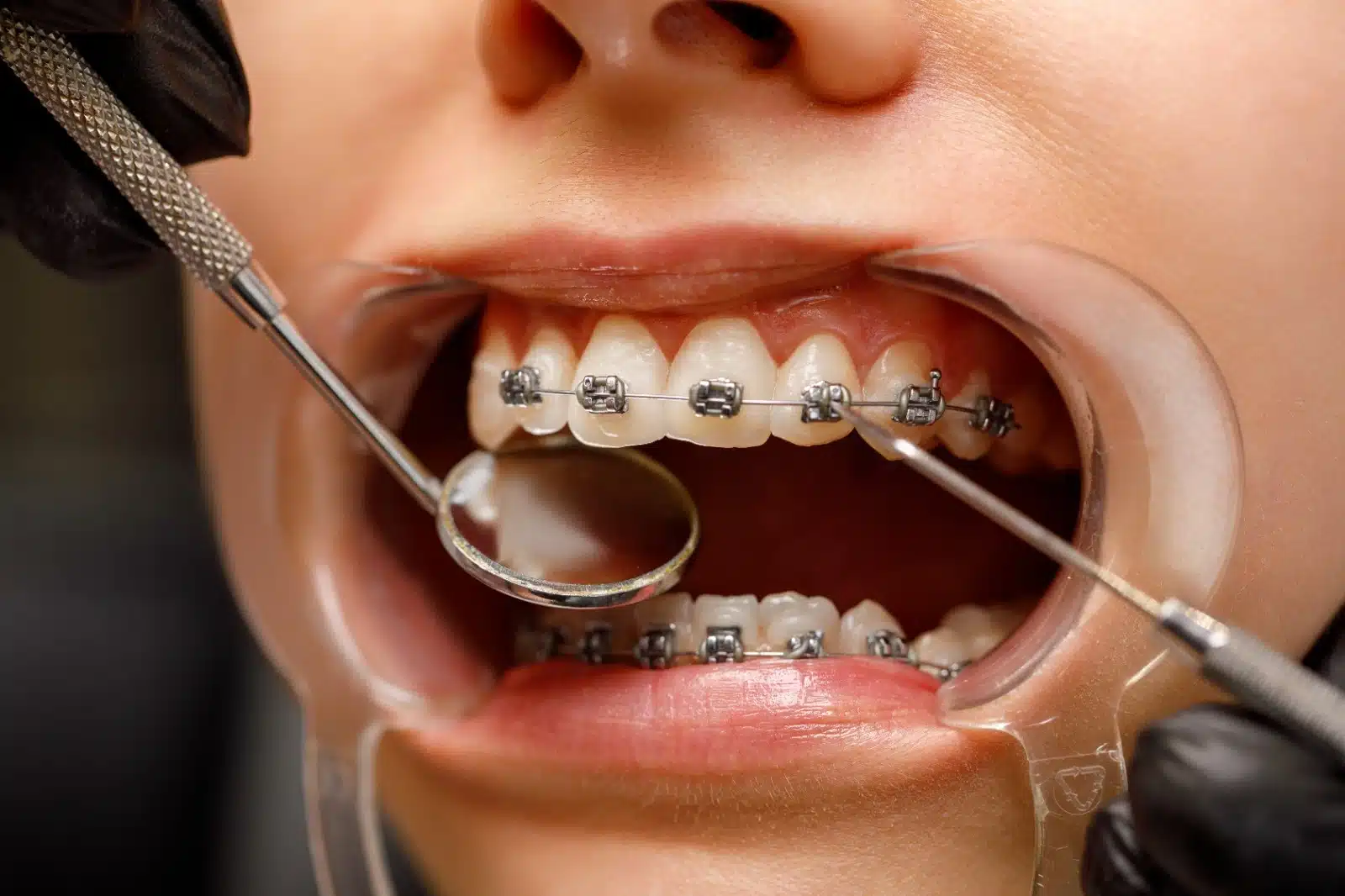 Best dental clinic in calicut