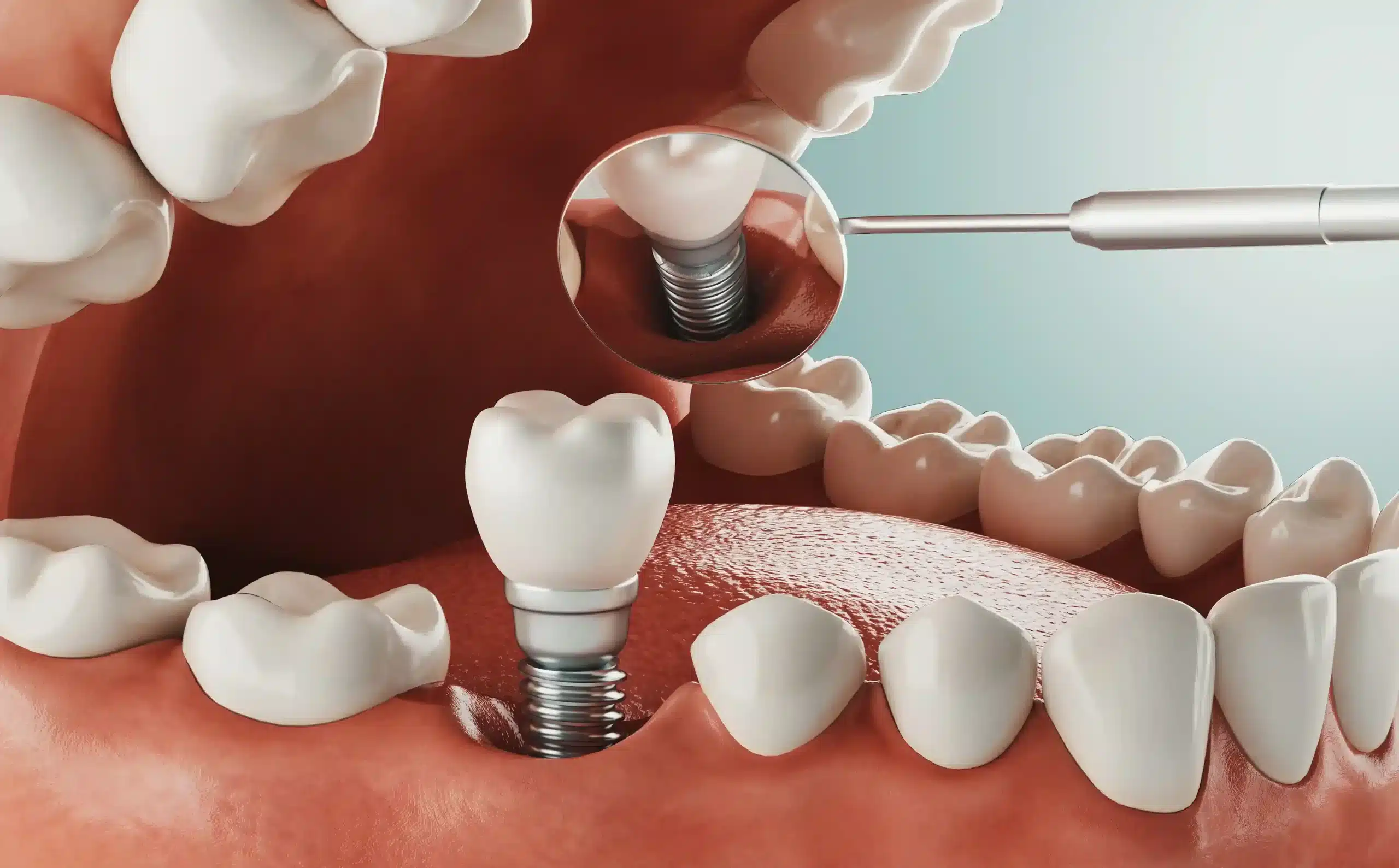 Best dental clinic in calicut